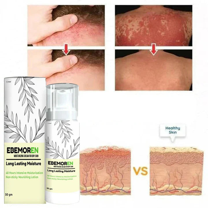 Anti Fungal Spray (Buy 1 Get 1 Free)