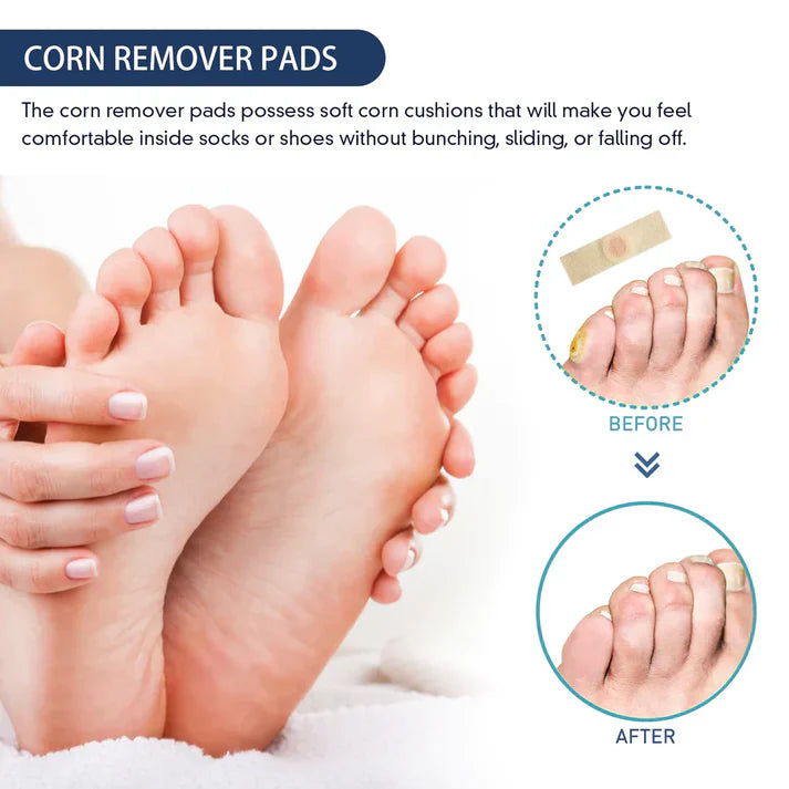 Corn Remover Pads (Pack of 24) - Buy 1 Get 1 Free🔥🔥